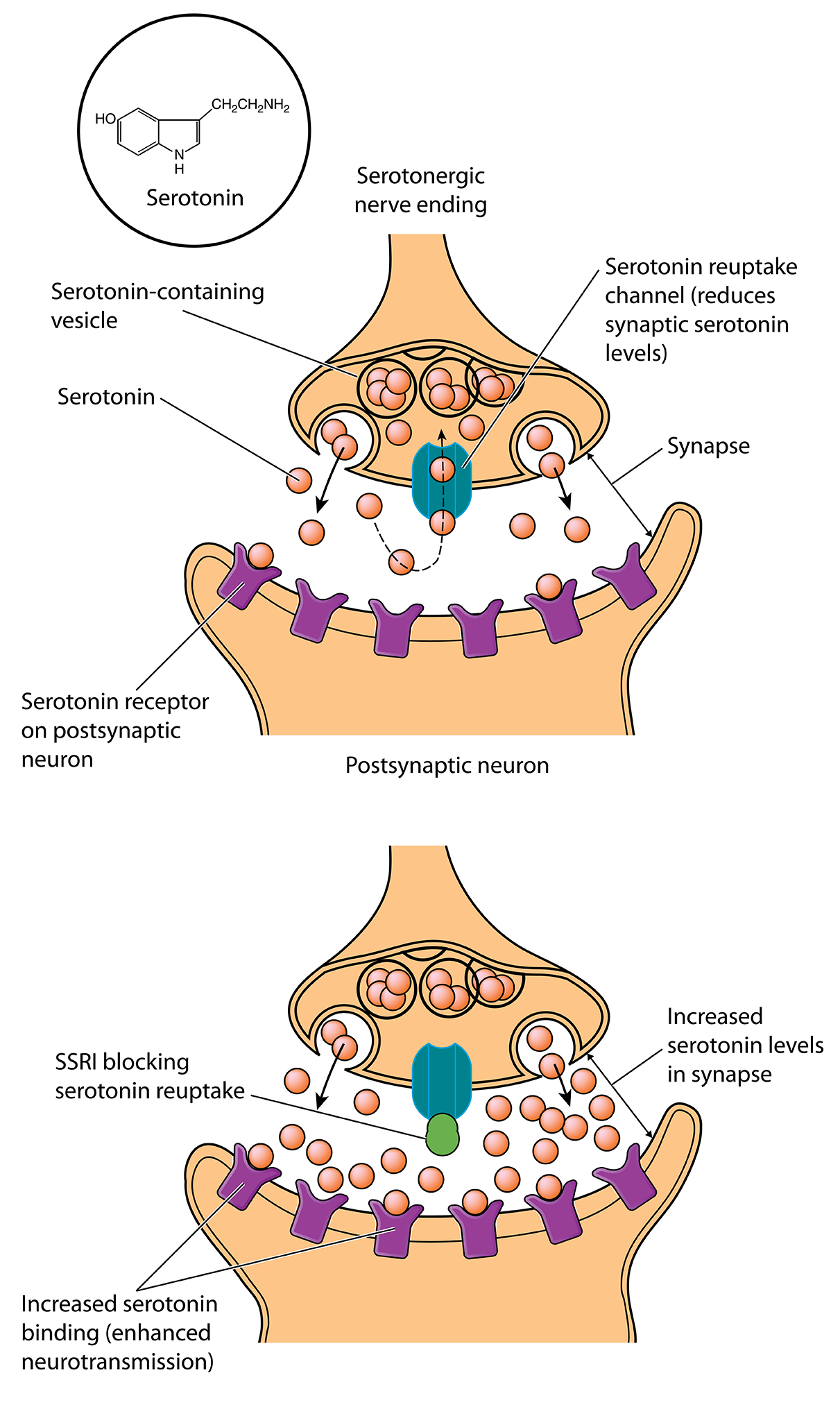 serotonin hypothesis of depression tryptophan