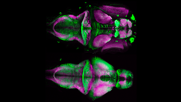 zebrafish embryo brain