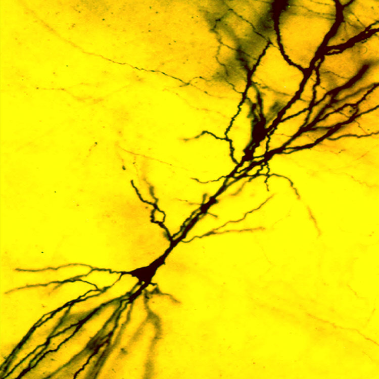 A single CA1 pyramidal cell from hippocampal area