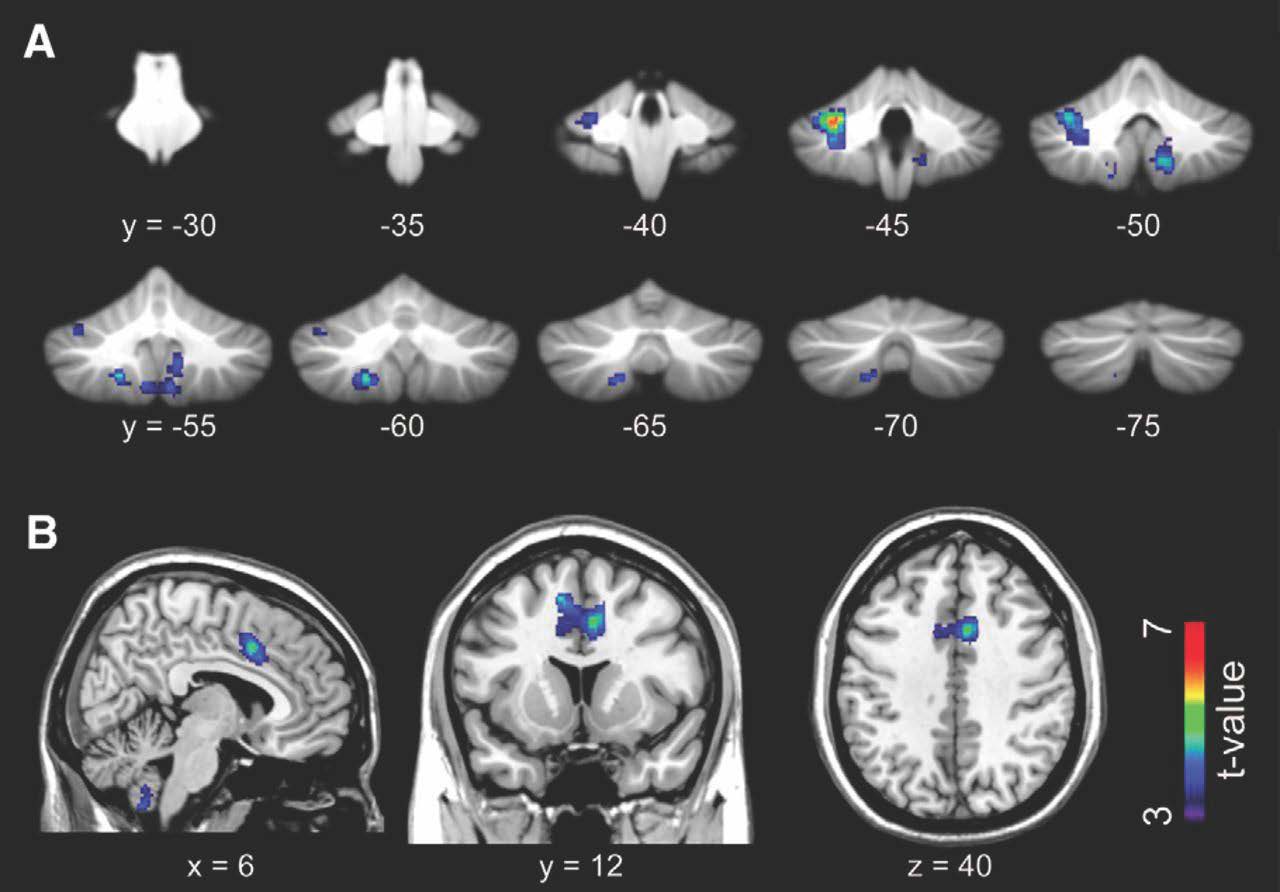 Authors show that real-time mutual interaction during eye contact is mediated by the cerebellum and limbic mirror system.