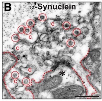 Image of electron micrographs of untreated, control lamprey synapses stimulated at 20 Hz for 5 min. 