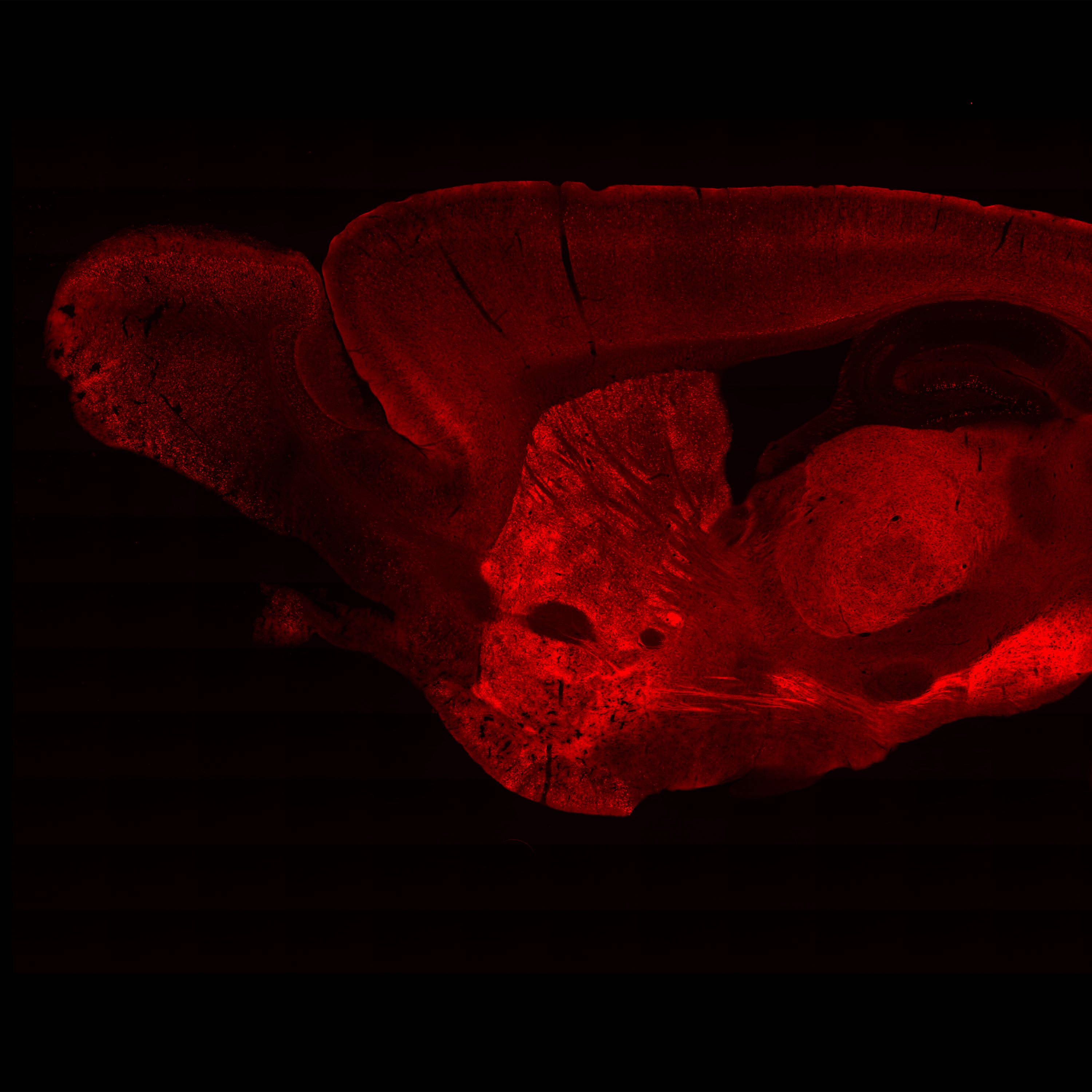 Image of neurons responding to medicinal and abused opioids in the mouse brain