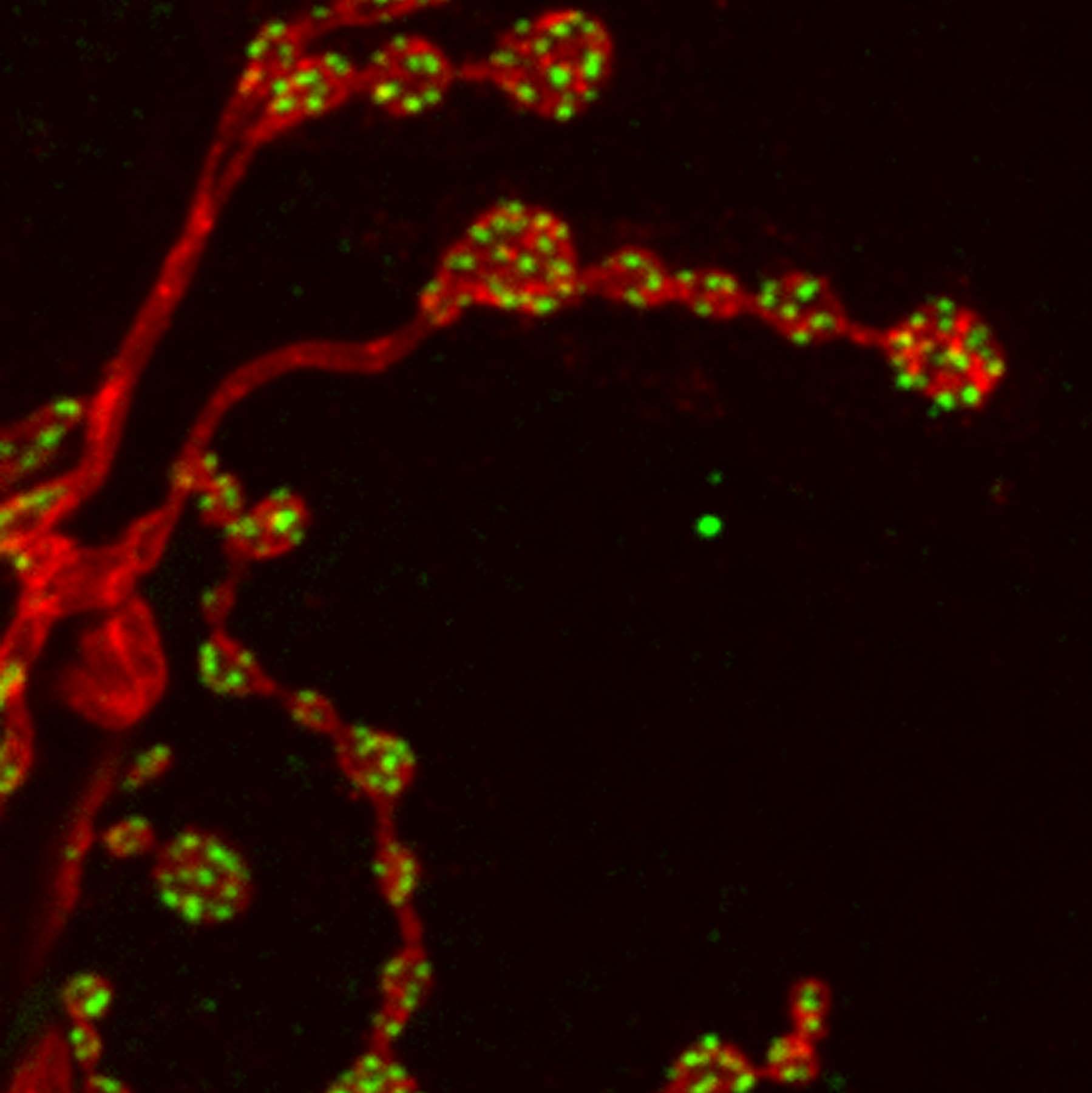 Synaptic boutons in the muscle of a larval fruit fly