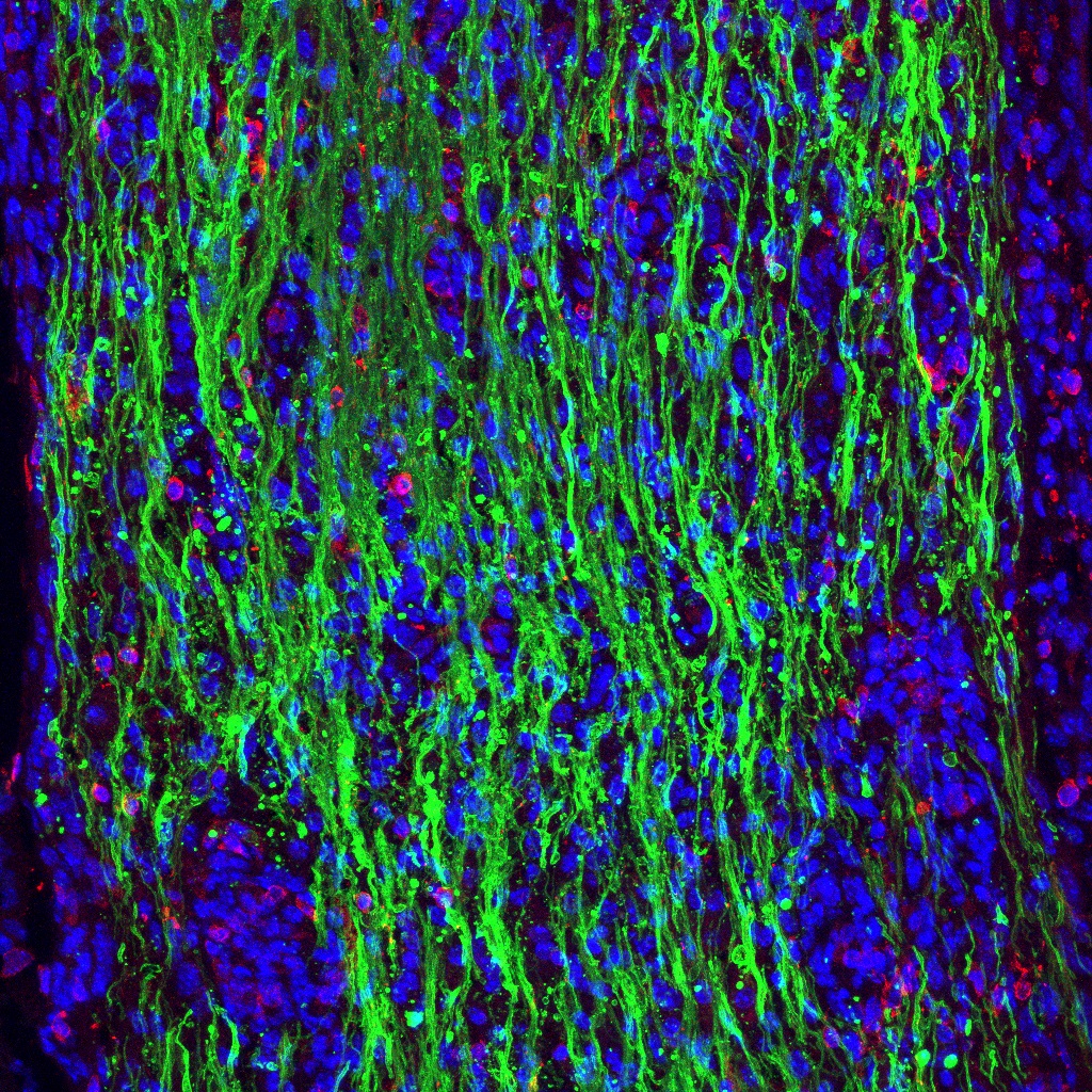 a 10 µm thickness section, stained for myelin basic protein (MBP) (green) which demonstrates the severity of demyelination that has occurred in this animal. 