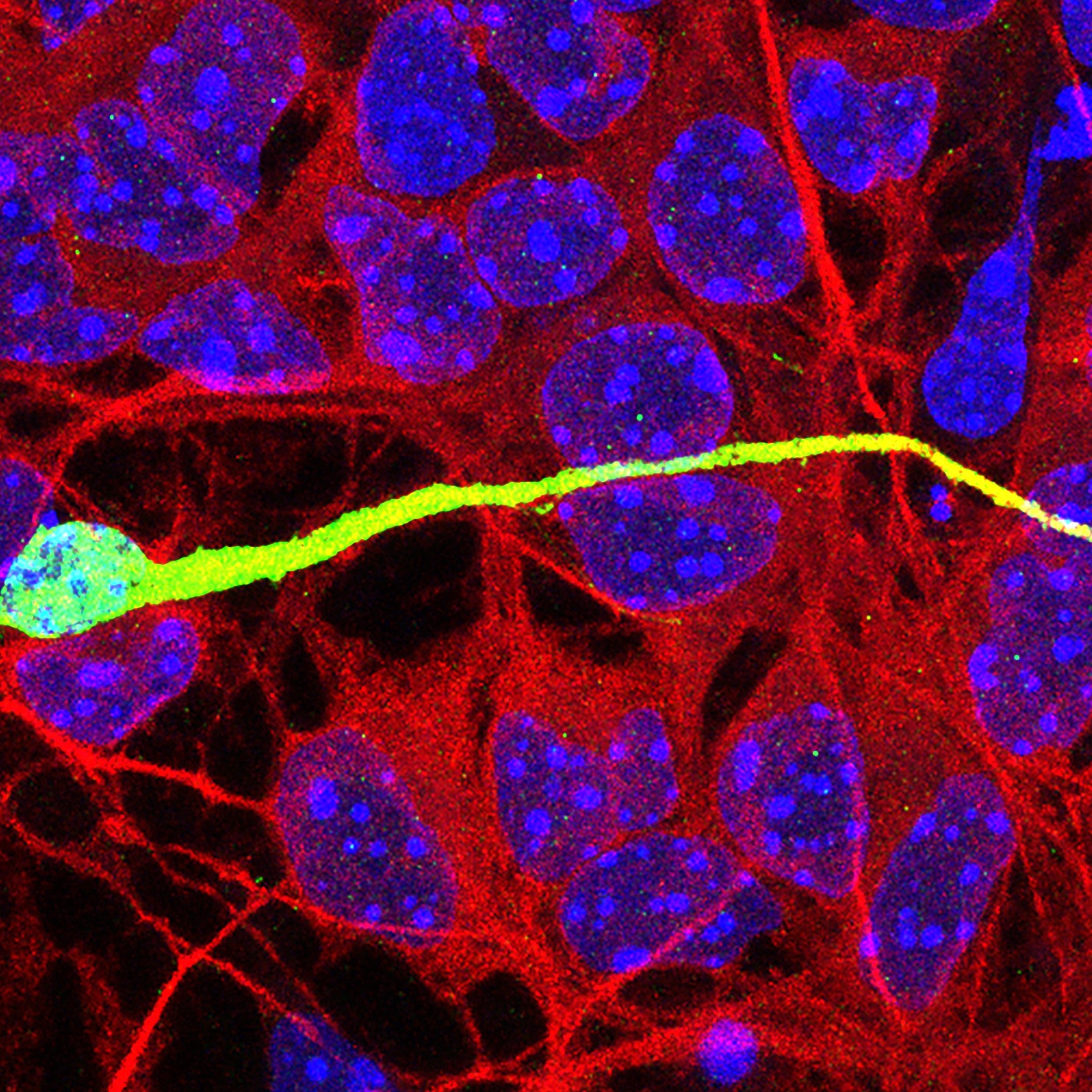 an interneuron migrating on a monolayer of cortical feeder cells in an in vitro co-culture assay