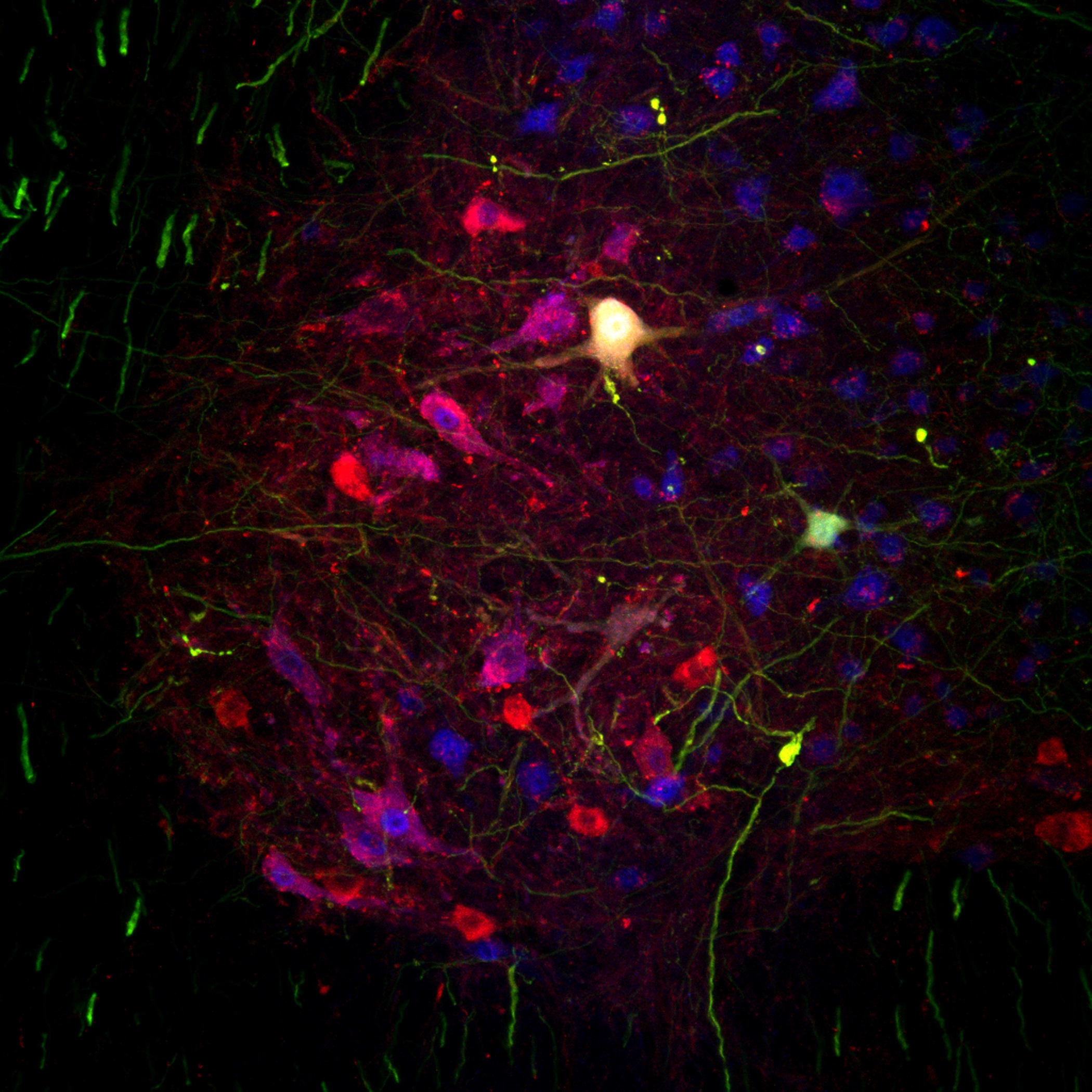 motor neurons in the ventral horn of the spinal cord of an ALS mouse model