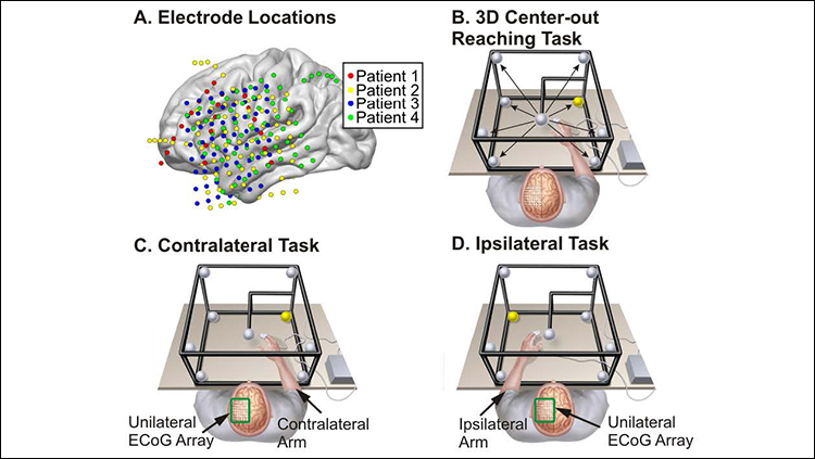 Study methodology. Patients implanted with electrocorticography arrays completed a 3D center-out reaching task. A, Electrode locations were based upon the clinical requirements of each patient and were localized to an atlas brain for display. B, Patients were seated in the semirecumbent position and completed reaching movements from the center to the corners of a 50 cm physical cube based upon cues from LED lights located at each target while hand positions and ECoG signals were simultaneously recorded. Each patient was implanted with electrodes in a single cortical hemisphere and performed the task with the arm contralateral (C) and ipsilateral (D) to the electrode array in separate recording sessions.
